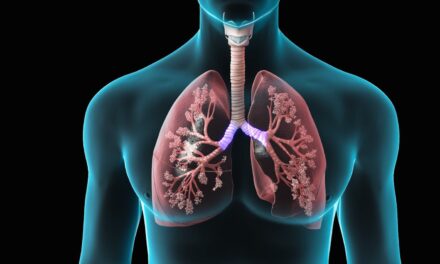 Vital Diagnosticar a Tiempo la Hipertensión Pulmonar