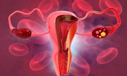 VPH Causante del 95% del Cáncer Cervical