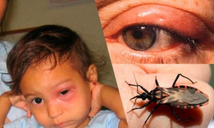 Aprueba COFEPRIS Tratamiento de Bayer vs Mal de Chagas