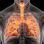 Asociada al Envejecimiento la Fibrosis Pulmonar